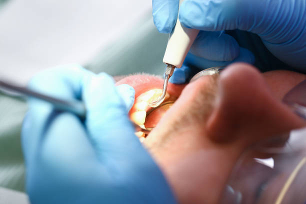 Best After-Hours Emergency Dentist in Oreana, IL